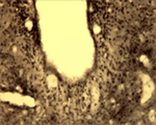 Anti-Activity-regulated cytoskeleton-associated protein (Arg3.1) Antibody - Image 8