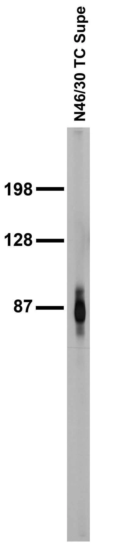 Anti-ADAM22 (Cytoplasmic) Antibody - Image 4