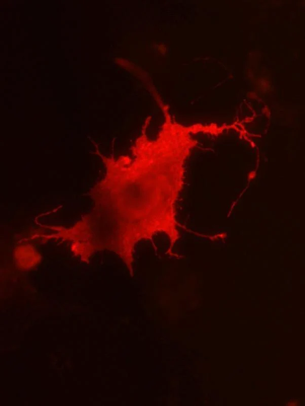 Anti-ADAM22 (Extracellular) Antibody - Image 4