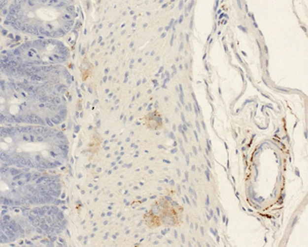 Anti-Alpha-Calcitonin Gene-Related Peptide (alpha-CGRP) Antibody