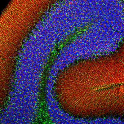 Anti-Alpha Synuclein Antibody - Image 2
