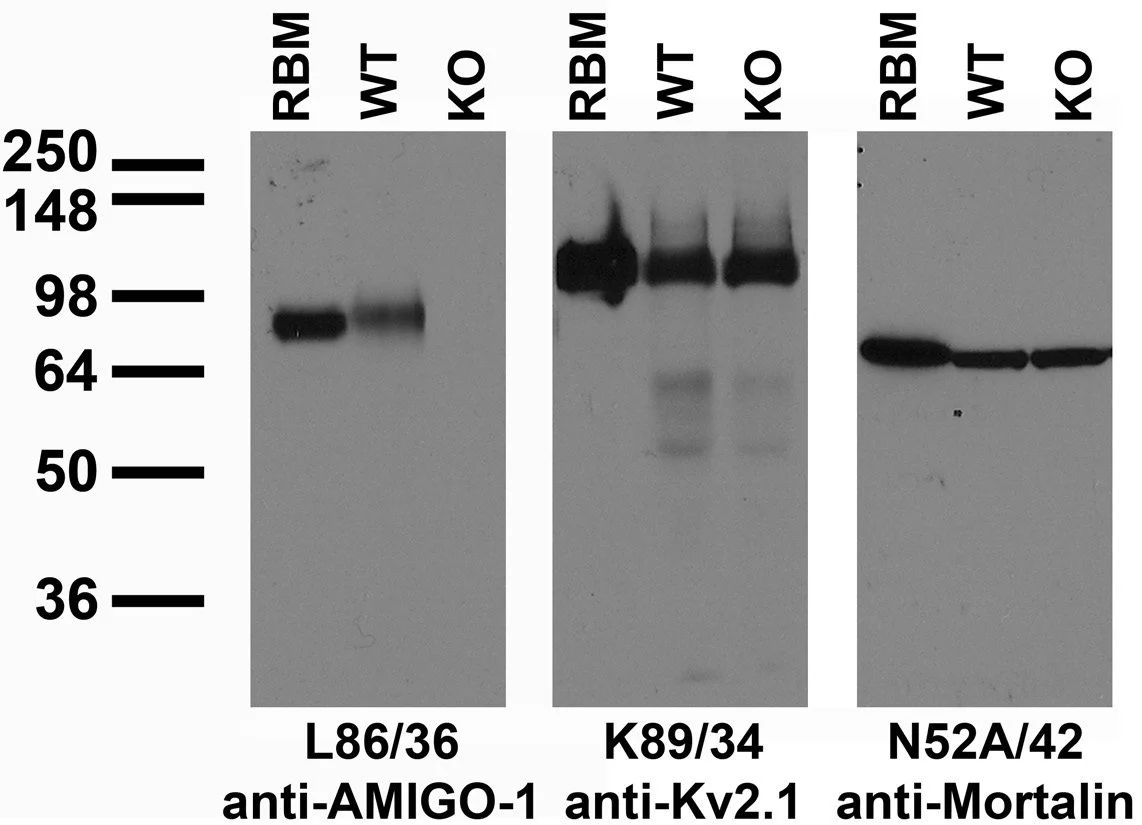 Anti-AMIGO-1 Antibody - Image 3