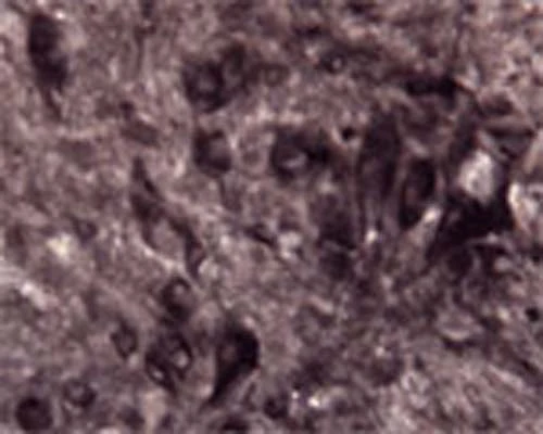 Anti-Amyloid-beta precursor protein (APP) Antibody