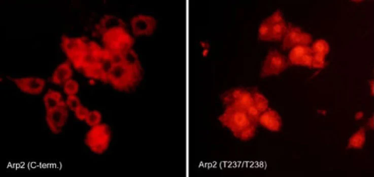 Anti-Arp2 (Thr-237/Thr-238), Phosphospecific Antibody - Image 2