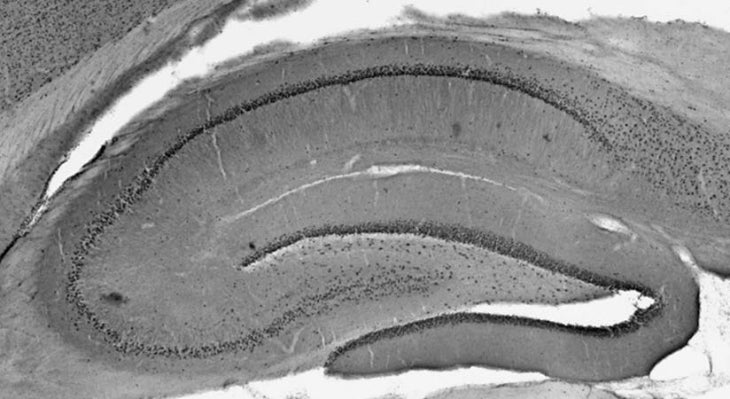 Anti-Ataxin-1, 11NQ Antibody - Image 2