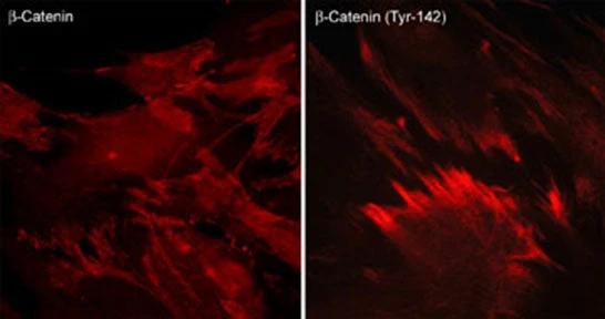 Anti-β-Catenin (Tyr-142) [γ-Catenin (Tyr-133)], Phosphospecific Antibody - Image 2