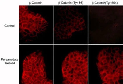 Anti-β-Catenin (Tyr-654) [γ-Catenin (Tyr-644)], Phosphospecific Antibody - Image 2