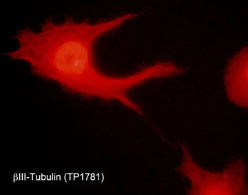 Anti-β-Tubulin (central region) Antibody - Image 2