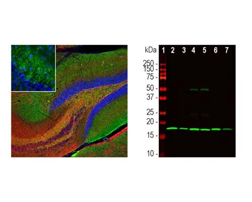 Anti-Beta-Synuclein Antibody