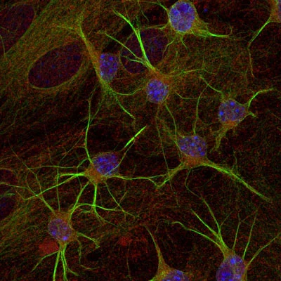 Anti-Beta-Tubulin 3 (TUJ) Antibody - Image 3