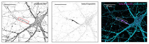 Anti-Beta4-Spectrin Antibody - Image 6