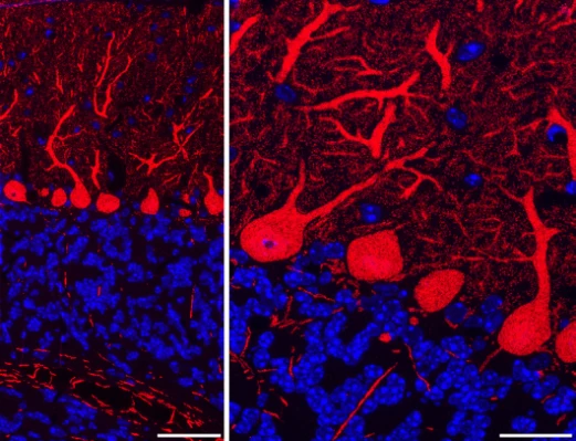 Anti-CALB1/calbindin Antibody