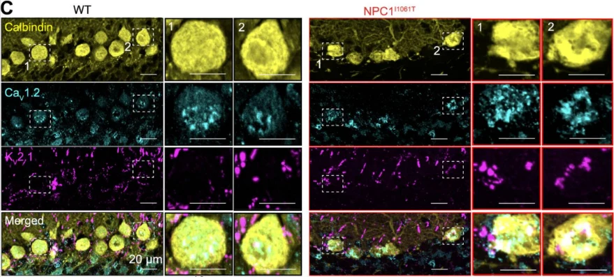 Anti-CALB1/calbindin Antibody - Image 4