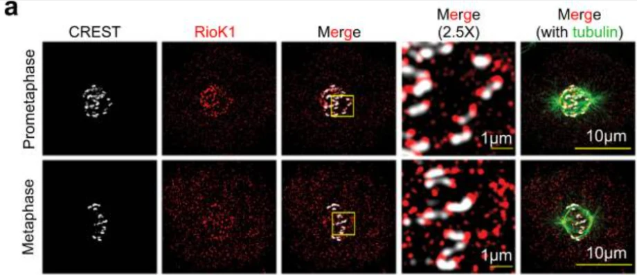 Anti-Centromere Protein Antibody - Image 16