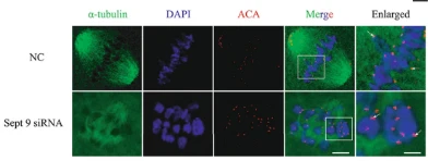 Anti-Centromere Protein Antibody - Image 4