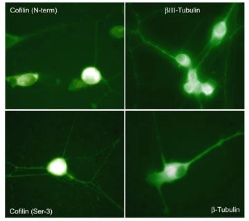 Anti-Cofilin 1 (Ser-3), Phosphospecific Antibody - Image 2