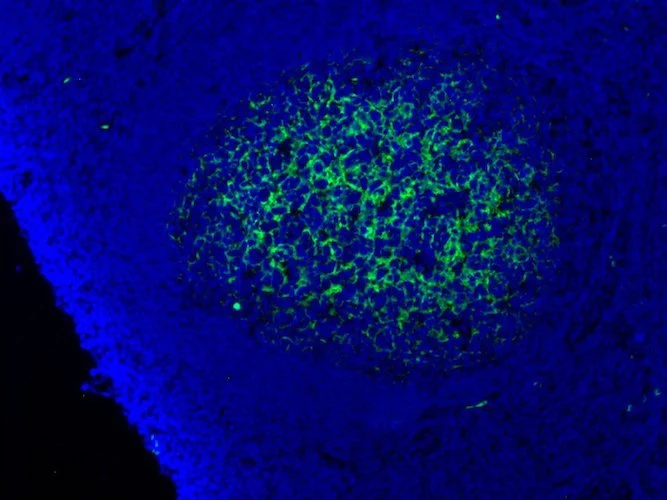 Anti-Complement C9 Antibody