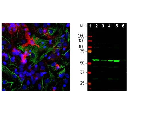 Anti-Coronin-1A Antibody - Image 2