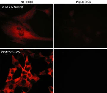 Anti-CRMP2 (Thr-555), Phosphospecific Antibody - Image 2