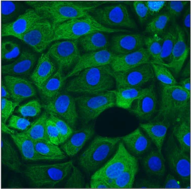Anti-Cytokeratin 19 (CK19) Antibody