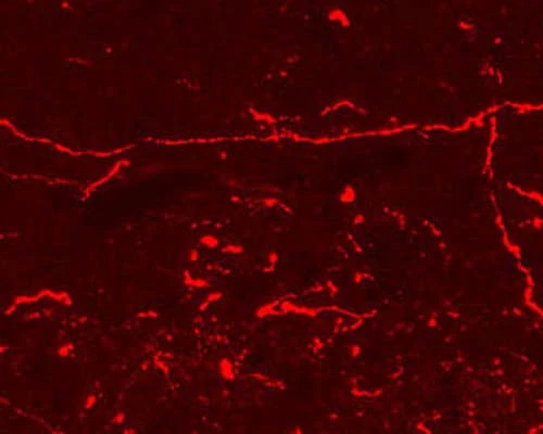 Anti-Endomorphin-1 and Endomorphin-2 (E-1/E-2) Antibody