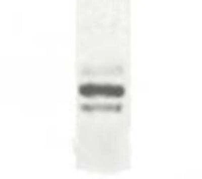 Anti-ESDN Antibody