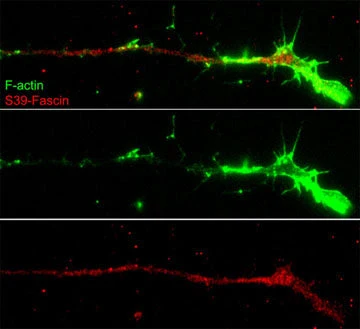 Anti-Fascin (Ser-39), Phosphospecific Antibody - Image 2
