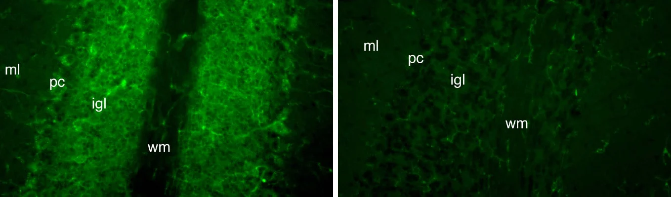 Anti-FGF14/FHF4 Antibody