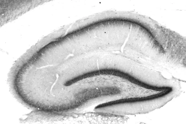 Anti-FGF14/FHF4 Antibody - Image 3