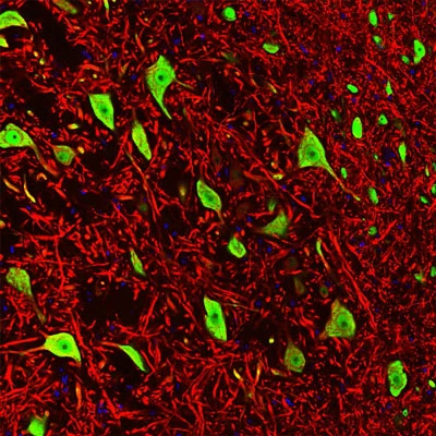 Anti-FOX3 (NeuN) Antibody - Image 2