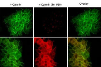 Anti-γ-Catenin (Tyr-550), Phosphospecific Antibody - Image 2