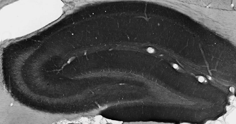 Anti-GABA-A-R, Beta1 Antibody - Image 2