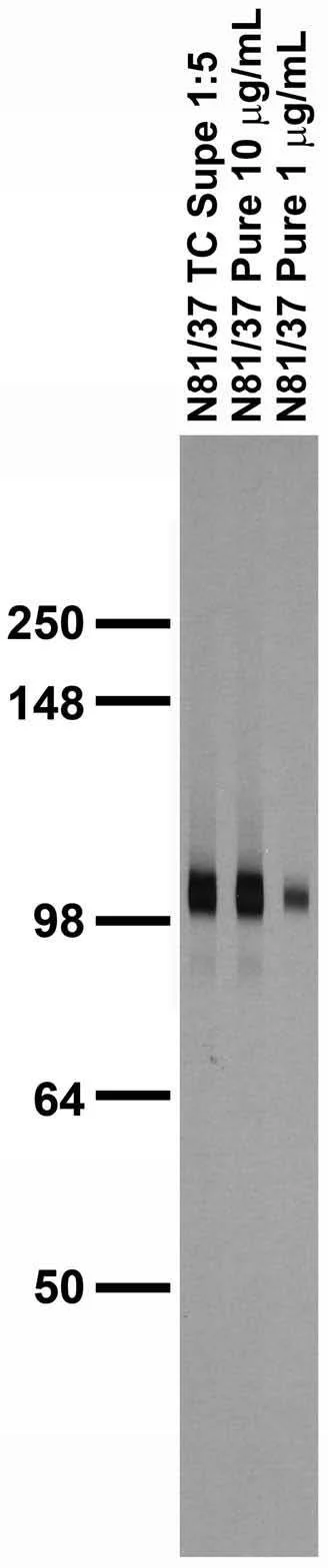 Anti-GABA-B-R2 Antibody - Image 4