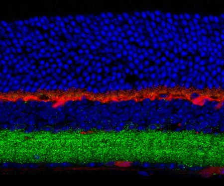 Anti-GABAA Receptor ß3 Antibody - Image 2