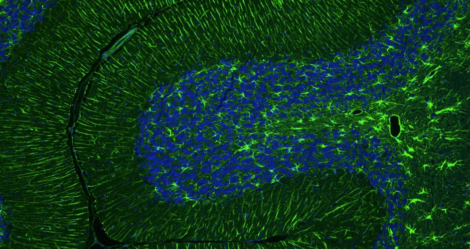 Anti-GFAP Recombinant Guinea Pig Chimeric mAb