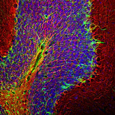 Anti-Glial Fibrillary Acidic Protein (GFAP) Antibody - Image 6