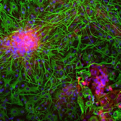Anti-Glial Fibrillary Acidic Protein (GFAP) Antibody - Image 8