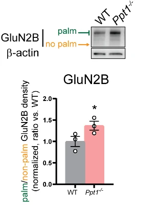 Anti-GluN2B/NR2B Glutamate Receptor Antibody - Image 6