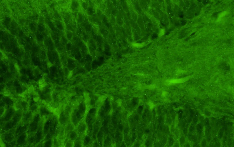 Anti-GluN2B/NR2B Glutamate Receptor Recombinant Chicken Chimeric mAb
