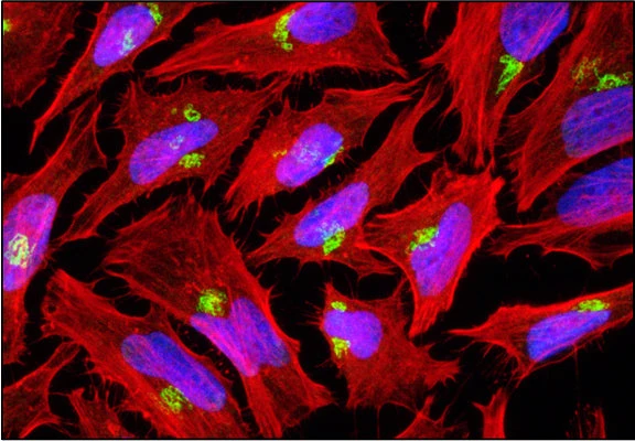 Anti-GOLGB1 (Giantin) Antibody