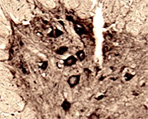 Anti-Huntingtin-associated protein 1 (HAP-1) Antibody - Image 2