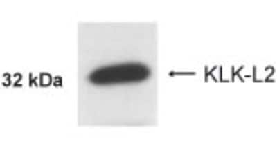 Anti-KLK-L2 (KLK5) Antibody