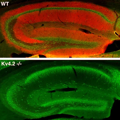 Anti-Kv4.2 K+ Channel Antibody