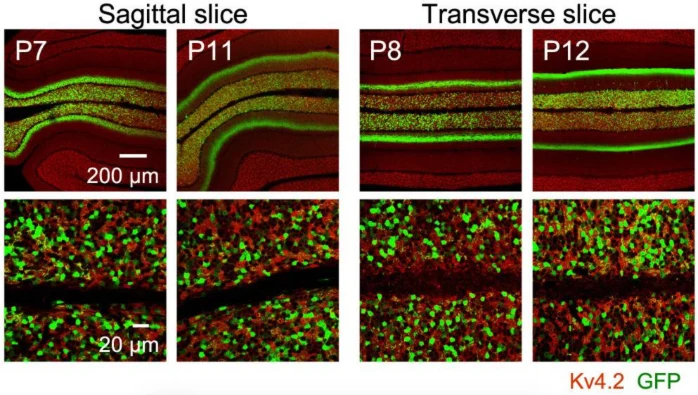Anti-Kv4.2 K+ Channel Antibody - Image 3