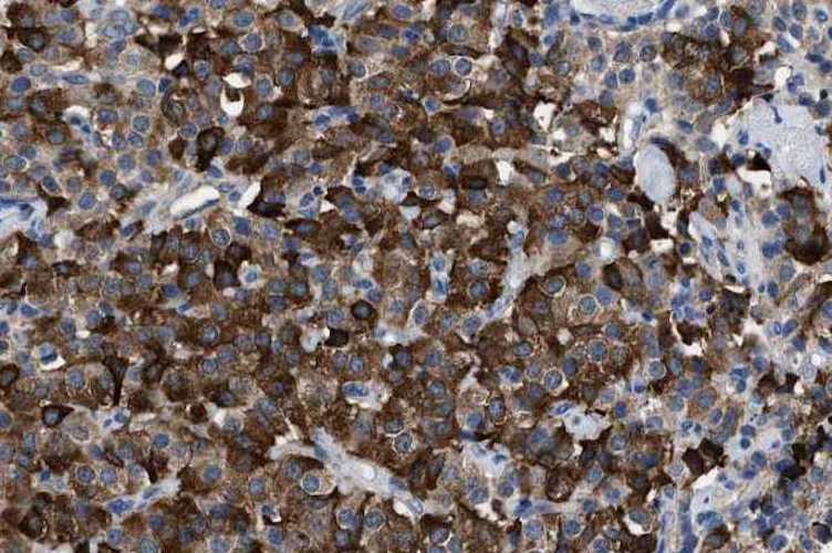Anti-Leptin Antibody
