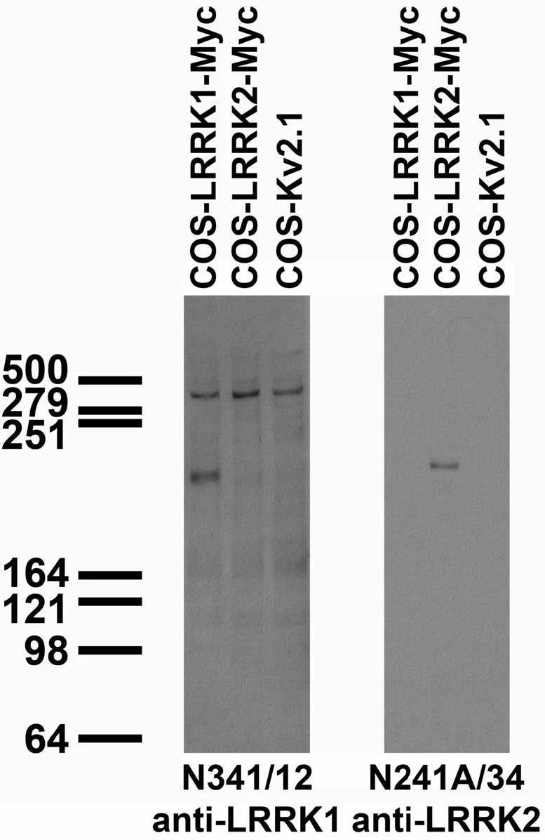 Anti-LRRK1 Antibody