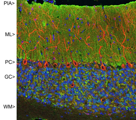 Anti-Microtubule Associated Protein 2 (MAP2) Antibody - Image 10