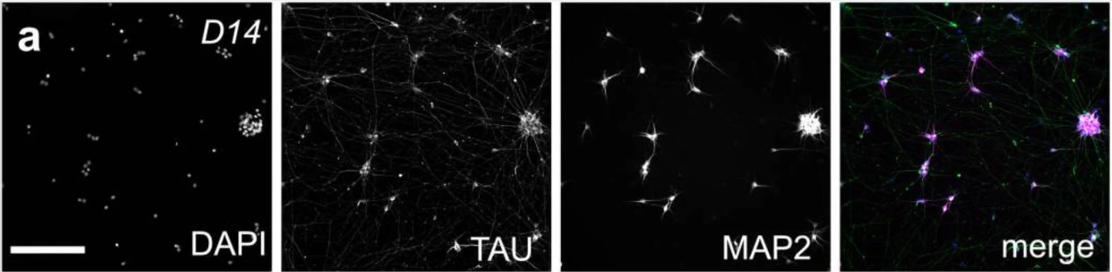 Anti-Microtubule Associated Protein 2 (MAP2) Antibody - Image 13