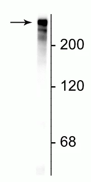 Anti-Microtubule Associated Protein 2 (MAP2) Antibody - Image 2