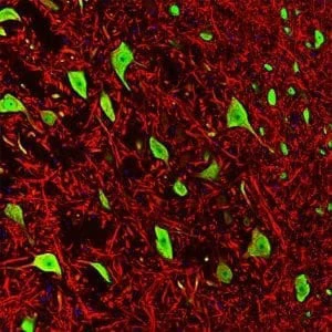 Anti-Microtubule Associated Protein 2 (MAP2) Antibody - Image 3
